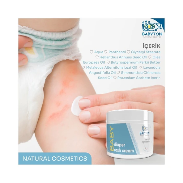 Babyton Diaper Rash Cream 50ml - Resim 3
