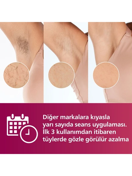 Philips Lumea Advanced SC1997/00 IPL Lazer Epilasyon Aleti - 5