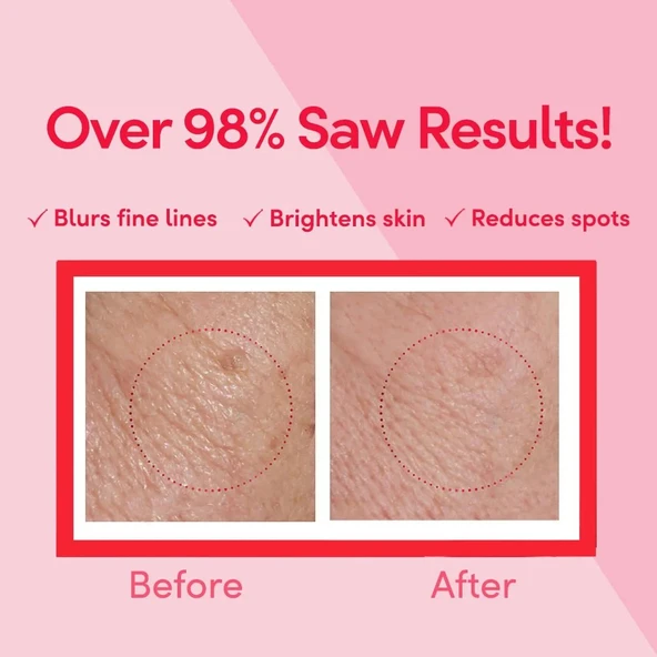 Ponds Age Miracle Wrinkle Kırışıklık Düzeltici Gündüz Kremi 50Gr - 4