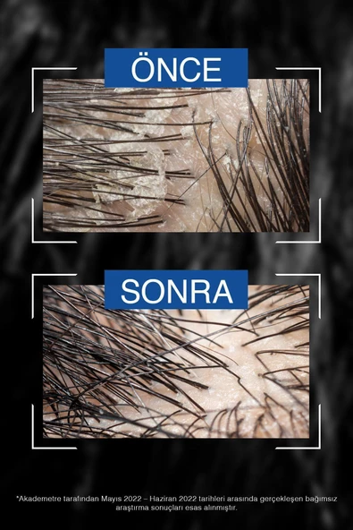 Bioblas Thermal Expert Men Kepek ve Saç Dökülmesine Karşı Şampuan 360 Ml - Resim 5