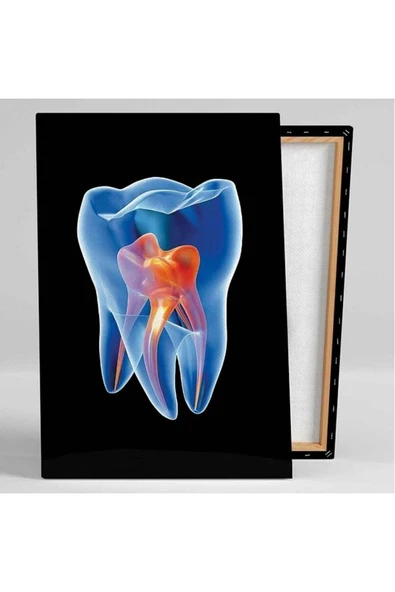 DİŞ HEKİMİ OFİS KANAL SİNİRLERİ DENTİST HEDİYELİK DEKARASYON SÜSÜ ÖLÇÜ SEÇMEYİ UNUTMAYINIZ. - 2