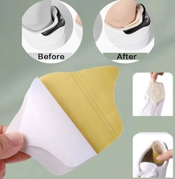 Taç Şeklinde Topuk Vurma Önleyici 10 mm. - Resim 2