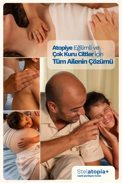 Mustela Stelatopia Lipit Yenileyici Krem Pompalı Şişe 300 ml - 2