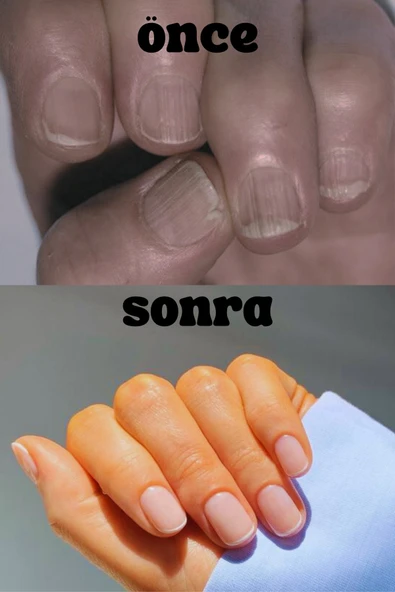 lazonail El ve Ayak Tırnak Besleyici, Onarıcı, Güçlendirici ve Koruyucu Tırnak Bakım Jeli - Resim 7