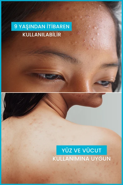 Ducray Keracnyl Gel Yağlı ve Akneye Eğilimli Ciltler İçin Temizleme Jeli 400 ml - Resim 8