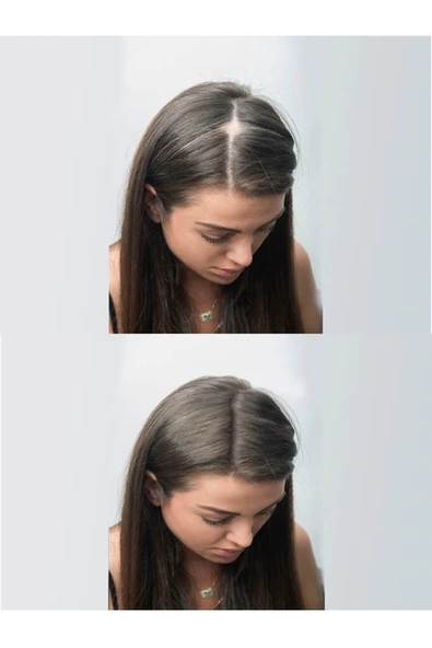 Saç Dolgunlaştırıcı Topik Toz - Dark Brown 50 gr - Resim 3