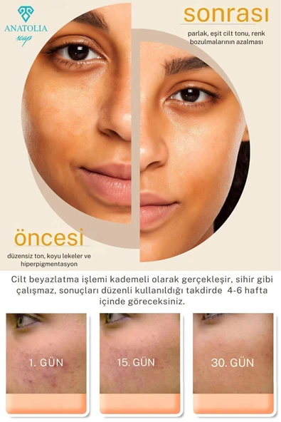 Kojik Asit Zerdeçal Sabunu Hücre Yenileyici Ciltteki Lekeleri Giderici Kolajen Etkisi Hyaluronik - 4