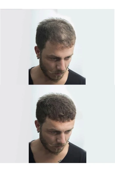 Saç Dolgunlaştırıcı Topik Toz - Dark Brown 50 gr - Resim 2