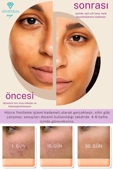 Retinage Retinol Sabunu Kırışıklık Karşıtı, Onarıcı Ceramide A Vitamini Yaşlanma Karşıtı Üzüm - 3