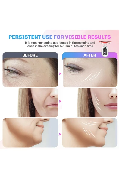 EXENAR Boyun ve Yüz Sıkılaştırıcı Cilt Bakım Cihazı Isıtmalı Masaj   3 Işık Modu  Şarjlı Lifting Cihazı - Resim 5