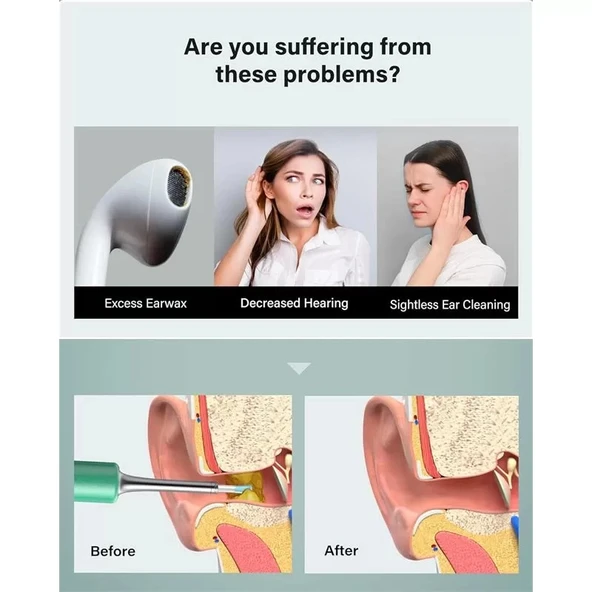 Bebırd T5 3mp Kamera 3.5mm Lens Şarjlı Wıfı Görüntülü Kulak Temizleyici Yeşil Renk - 2