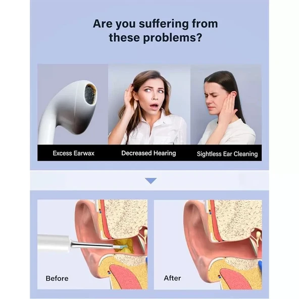 Bebırd T5 3mp Kamera 3.5mm Lens Şarjlı Wıfı Görüntülü Kulak Temizleyici Beyaz Renk - 2