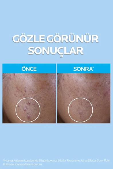 La Roche Posay Güneş Korumalı Cilt Bakım Seti : Effaclar Yüz Temizleme Jeli 400ml & Anthelios Yüz Güneş Kremi 15ml