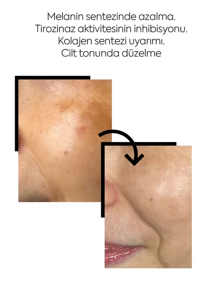 Clasy Care, Face Up Skin, Aydınlatıcı Leke Kremi Kremi - 40 ml - Resim 2