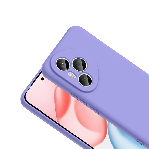 Honor 400 Pro Kılıf Kamera Korumali Mara Lansman Kapak - Resim 9