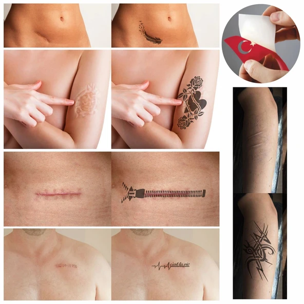 Yara Faça İzi Kapatma Dövme Şablonu Seti Kalp Fermuar - Resim 2