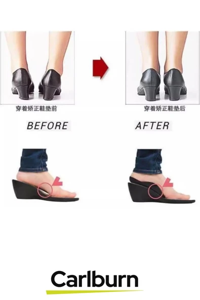 Özel Üretim Yumuşak Silikon Yürüyüş Konfor Artırıcı Esnek Düz Taban Düzeltici Topuk Yastığı - 3