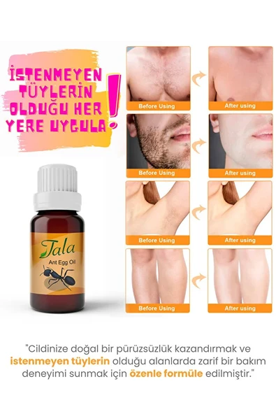 Tala Karınca Yumurtası Yağı Tüy Azaltıcı Tüy İnceltici Tüy Dökücü 20 Ml - 5