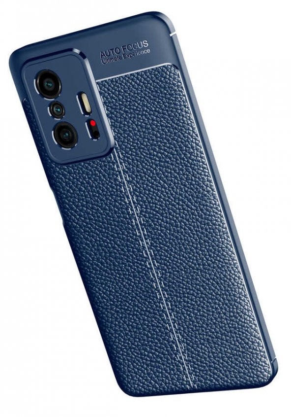 Xiaomi Mi 11T 5G Kılıf Deri Desenli Kamera Korumalı Silikon - 3