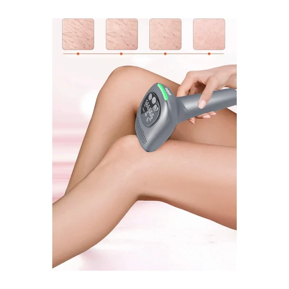 SİNBO SEL-6044 IPL EPİLATÖR - Resim 4