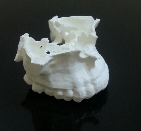 Maxilla Plastik Aparat - 1