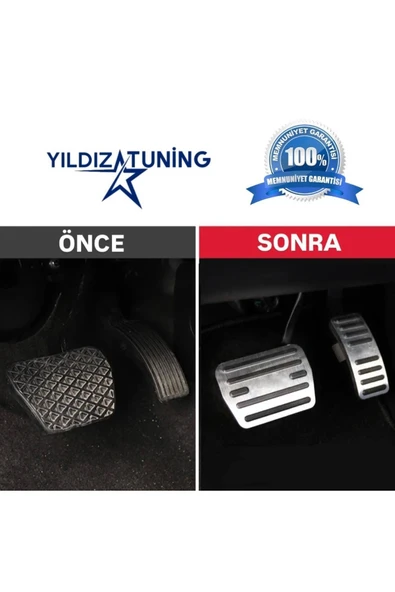 YıldızTuning Chery Omoda 5 Tiggo 7 8  Otomatik Pedal Seti - 2