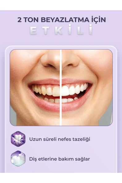 Splat Diş Macunu 4 Ton Beyaz 75 ml - Resim 2