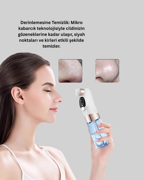 Elektrikli Siyah Nokta Sökücü – Derinlemesine Gözenek Temizleme Cihazı - Resim 2