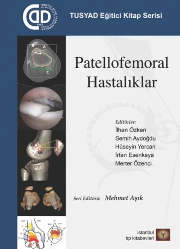 TUSYAD Eğitici Kitap Serisi - Patellofemoral Hastalıklar ürün görseli