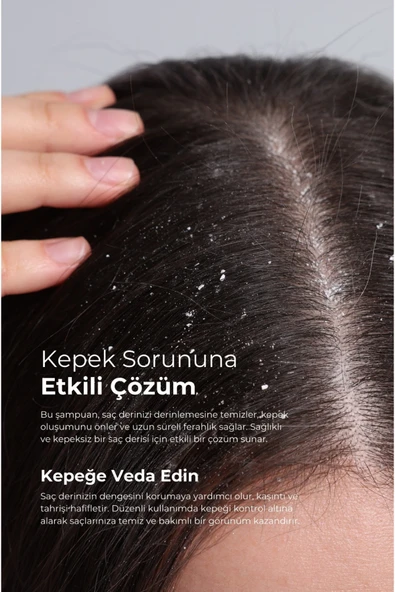 Tto X Kepekli ve Yağlı Saçlara Özel Şampuan Kolajen ve Prebiyotik - Resim 2