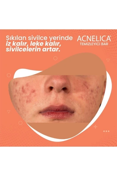 ACNELİCA Temizleyici Bar %2 Siyah Nokta Ve Sivilce Sabunu - 4