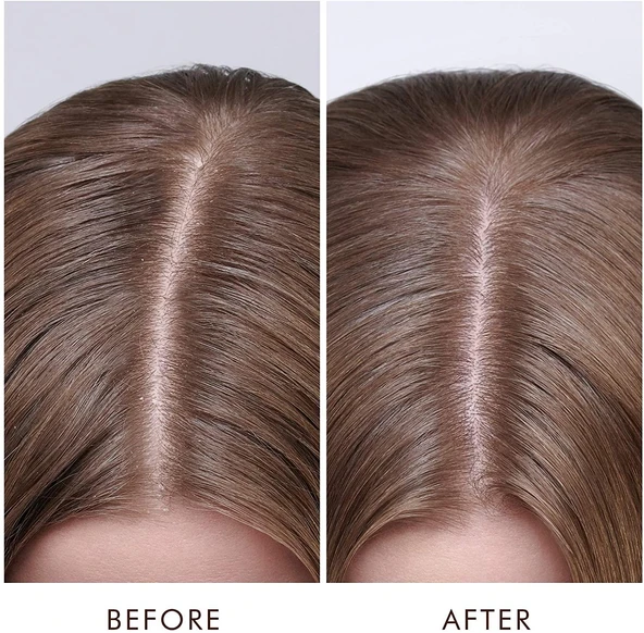 Moroccanoil Dry Scalp Treatment Kuru Saç Derisi Serumu 45ML - Resim 3