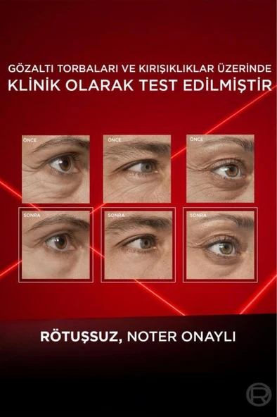 Loreal Paris Revitalift Lazer Eyebag Instant Eraser Göz Altı Torba Görünümüne Karşı Etkili Göz Kremi 15ml - Resim 5