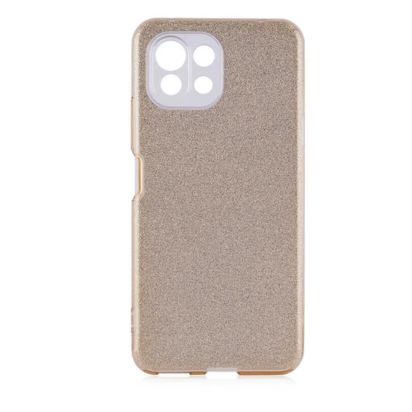 Zore Xiaomi ile uyumlu Mi 11 Lite Kılıf Shining Silikon - 5