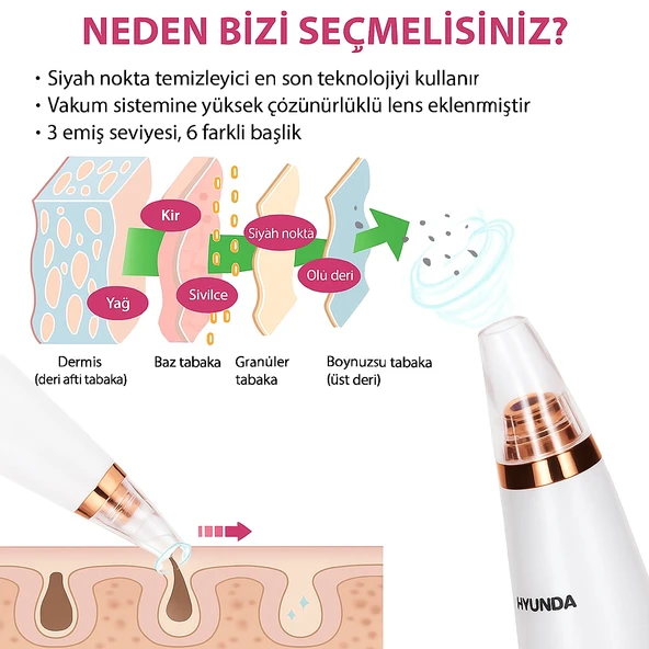 Hyundai Vakumlu Siyah Nokta Temizleyici  6 Başlık, Güçlü Vakum, Şarjlı 6 Başşlıklı - 4