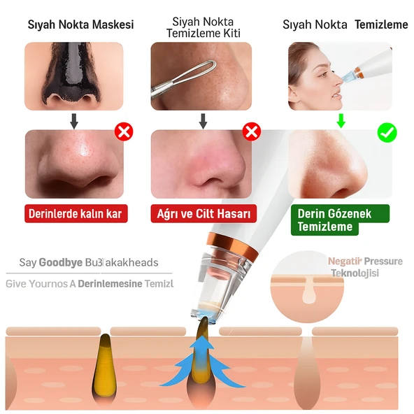 Hyundai FC-038 Vakumlu Siyah Nokta Temizleyici  3 Modlu Emiş Gücü Cilt Gözenek Temizleyici - 4