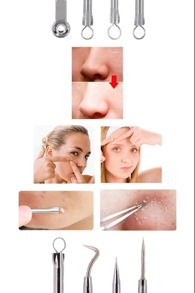 4 lü Kutulu Paslanmaz Komedon Akne - Siyah Nokta Temizleyici Set - 3