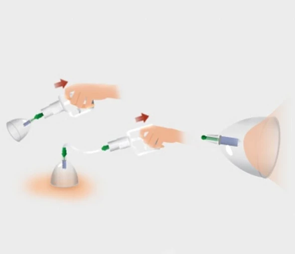 Vakumlu Göğüs Büyütücü - Resim 2