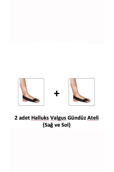 HALLUKS VALGUS GÜNDÜZ ATELİ SAĞ VE SOL - 1