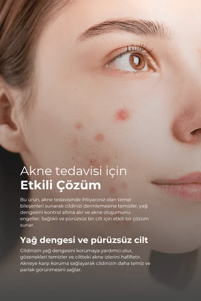 Tto Akne ve Rozasea Bakım Seti Temizleme Jeli Dermodicos Plus - Resim 2