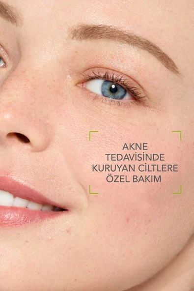 Bioderma Sebium Hydra Yoğun Nemlendirici Seramid İçeren Kurutucu Akne Tedavisi Yatıştırıcı Bakım Kremi 40 ml - Resim 3