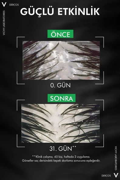 Vichy Dercos Şampuan Normal/Yağlı ve Kepekli Saç Derisi 390 ml - Resim 3