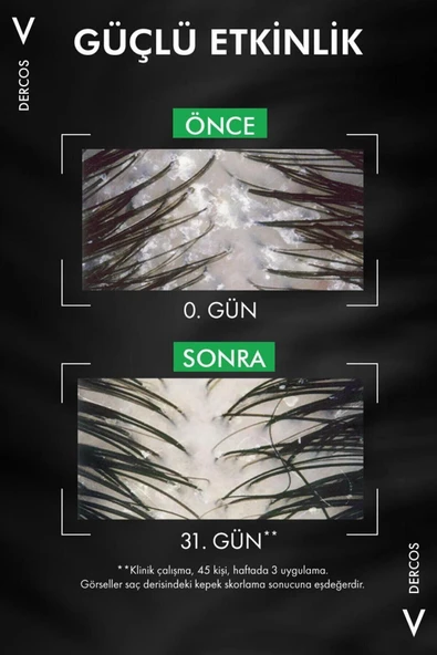 Vichy Dercos Anti-dandruff Kepek Karşıtı Şampuan Normal & Yağlı Saçlar 390 ml X 2 Adet - Resim 2