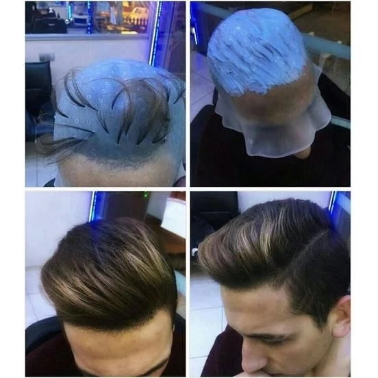 Profesyonel Silikon Delikli Röfle Bonesi - 5