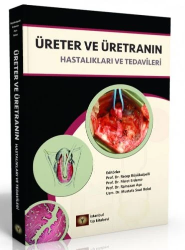 Üreter ve Üretranın Hastalıkları ve Tedavileri ürün görseli