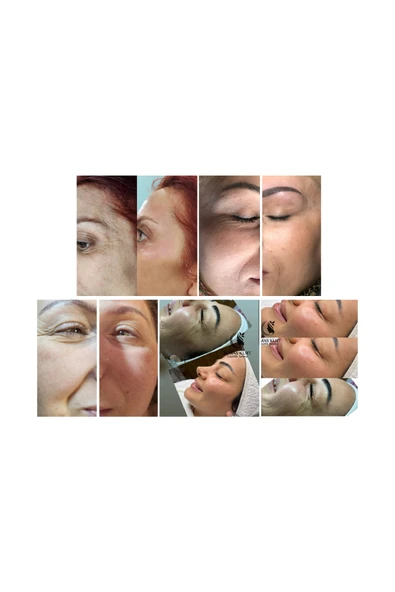 bioskin Derma plus dolgu tozu protocol serum ünite - Resim 4