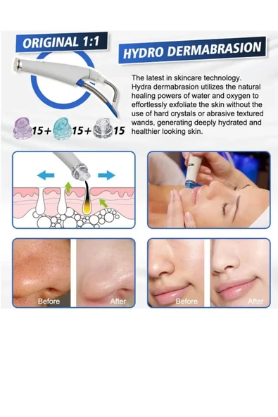 DG DERMO GOLDEN Hydrafacial Cilt Bakım Cihazı - Resim 4