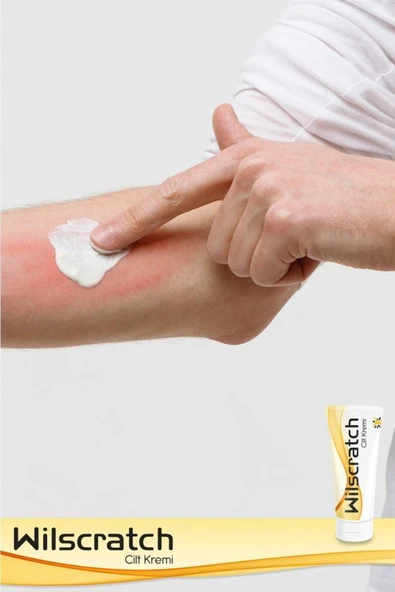 WİLSCRATCH Cilt Kremi 100 Gr ürün görseli