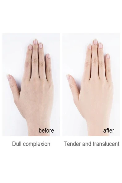 MÖOYAM Niacinamide Keçi Sütü El Maskesi - 5