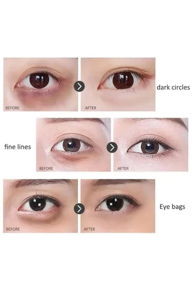 TWG Kırışıklık Karşıtı& Sıkılaştırıcı Göz Altı Bakım Serumu 20ml - Resim 5